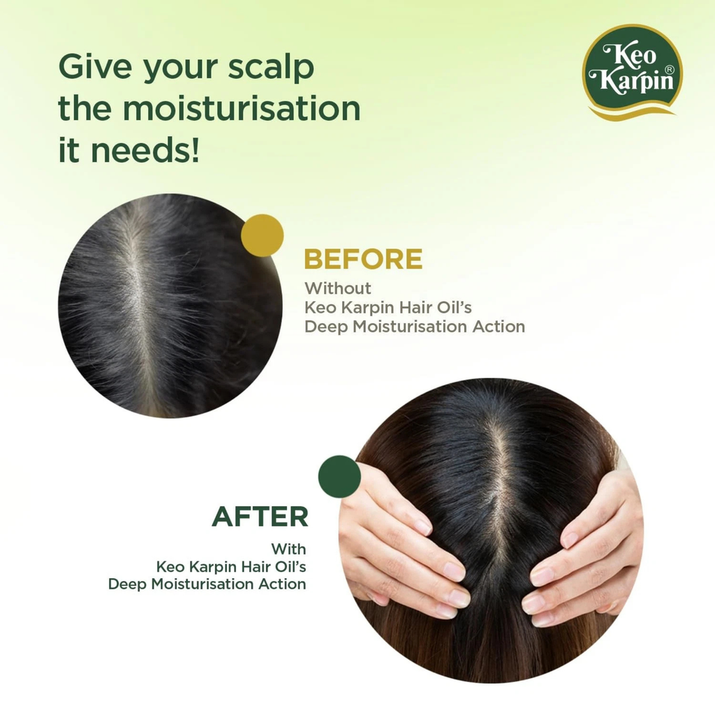 Advertisement for Keo Karpin hair oil showing a comparison of scalp before and after use.