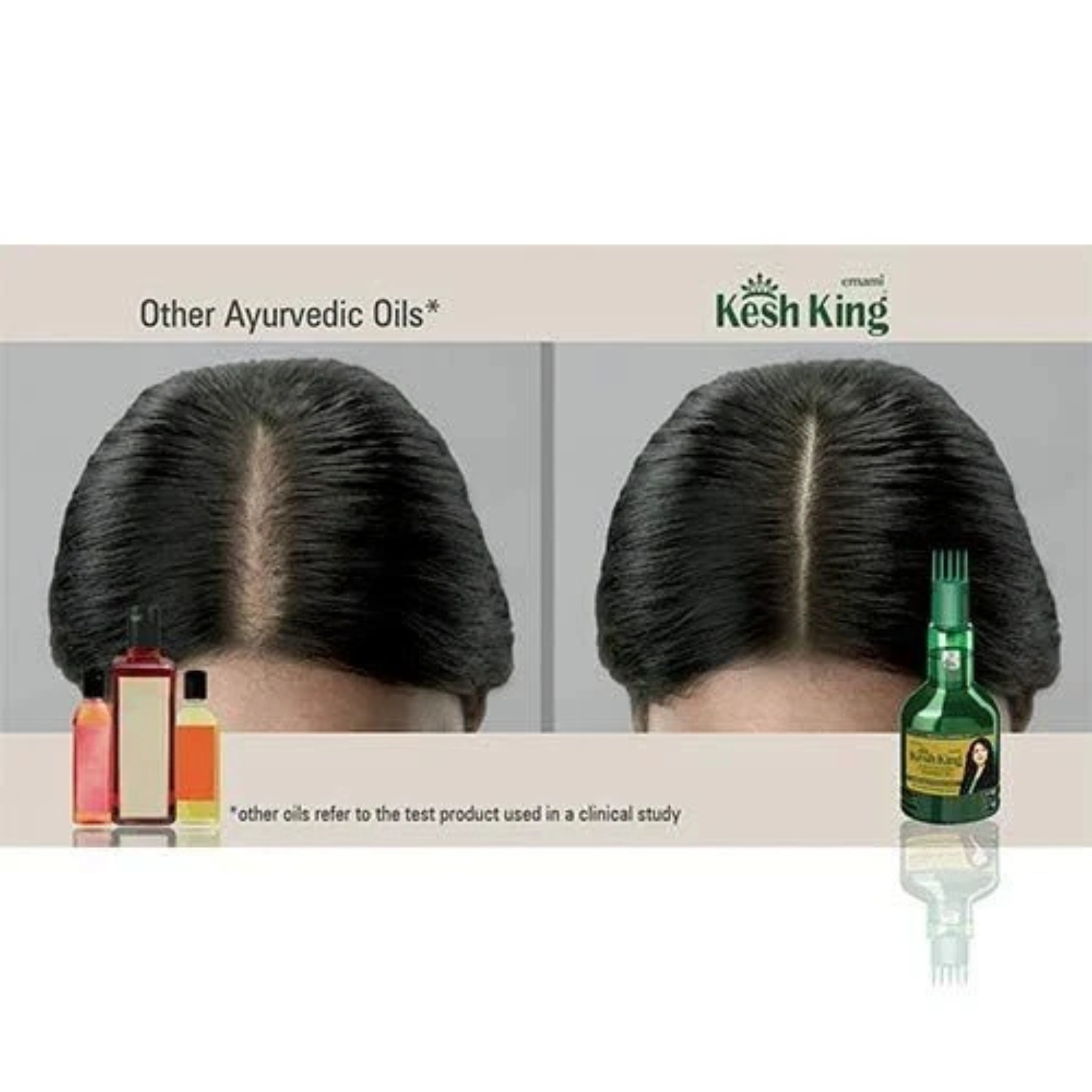 Advertisement for Kesh King hair oil showing a comparison of hair health before and after use.